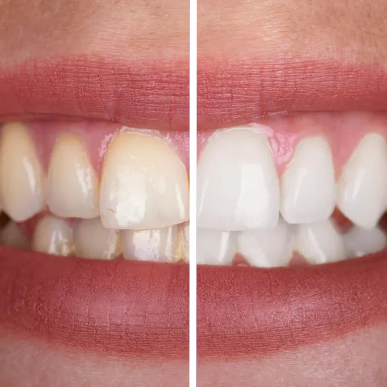 SmartBrush - Whitening & Repairing Toothpaste